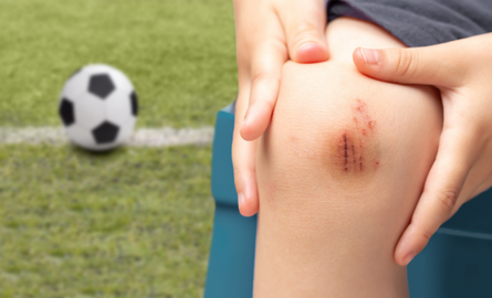 Child's scrapped knee with soccer ball in background.
