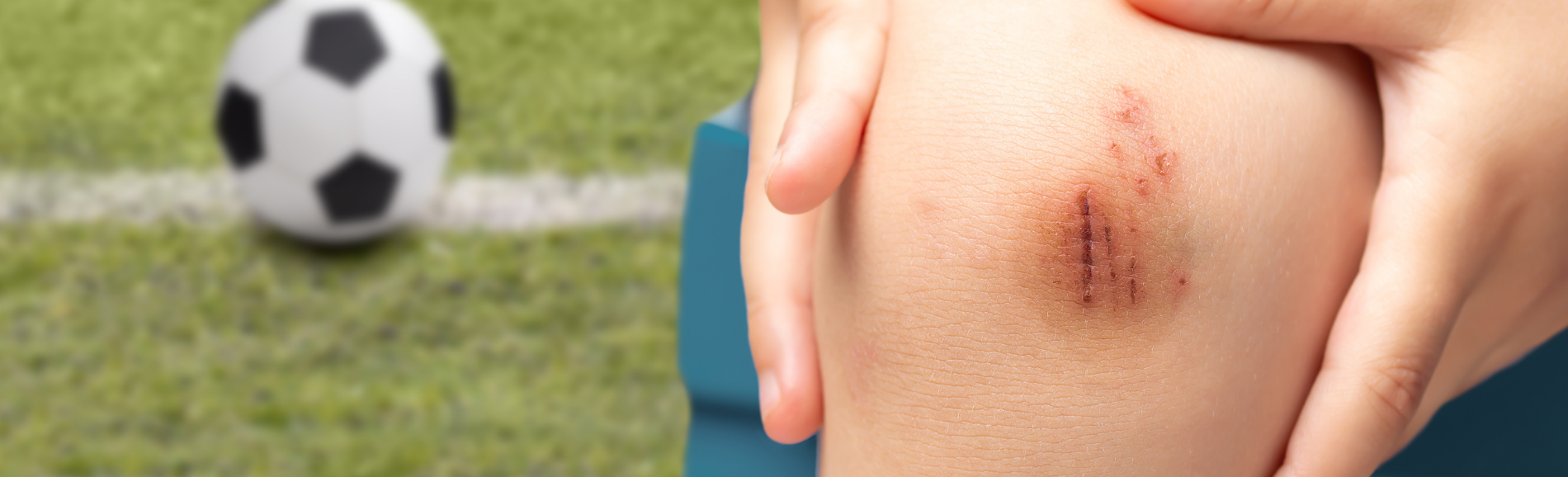 Close up of child's scrapped knee with soccer ball in background.